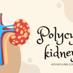 Kidney Donation: Is it okay to sell my kidney?